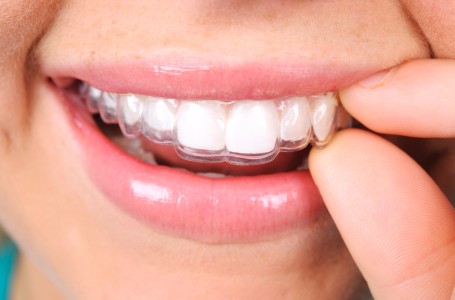 Invisalign Clear Orthodontic Aligners, Medicine Hat Dentist